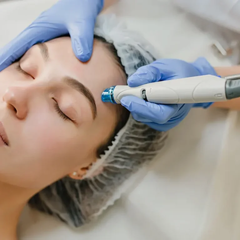 main_microneedling