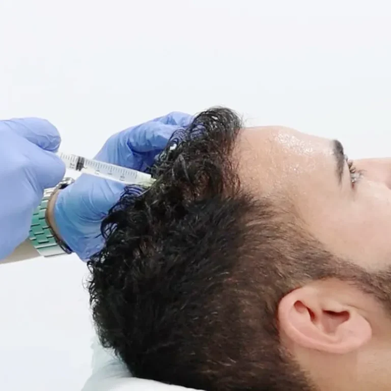 mesoterapia_1